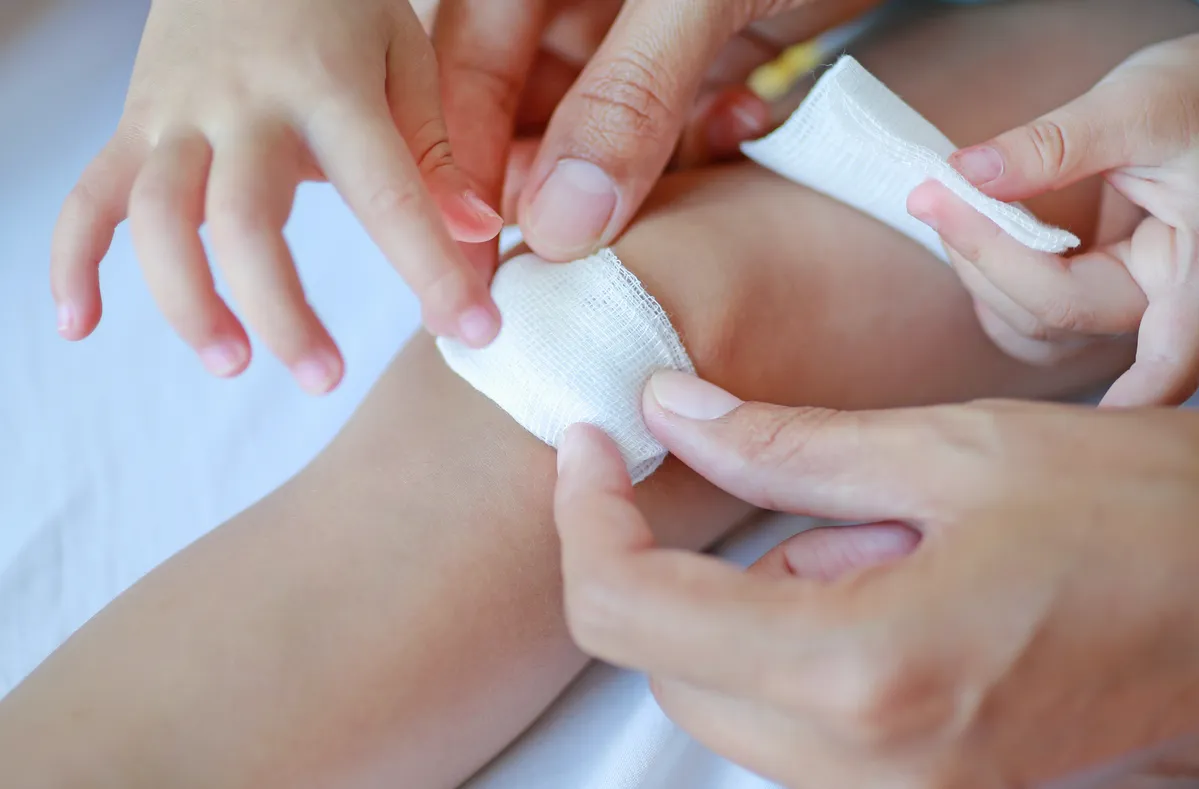 someone is putting a bandage on a child ' s leg