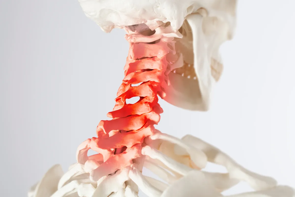 Types of Whiplash Injuries and Their Symptoms Cover Image
